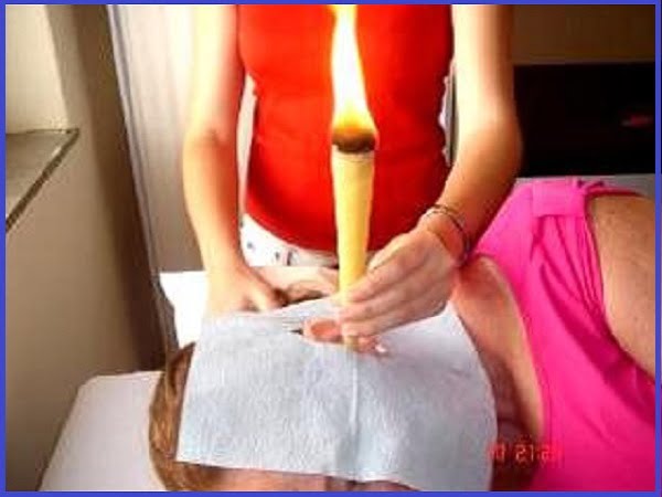 Limpeza de Ouvidos - Cone Chinês - Dé Schmitz - São José SC - Limpeza de Ouvidos – Terapia do Cone Chinês – para excesso de cera (cerume), coceira, zumbido, pressão interna, umidade, otite, dor de ouvido, baixa audição, surdez temporária. Ajuda no tratamento da sinusite, rinite, dor de cabeça e labirintite.