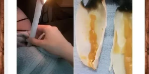 Limpeza dos ouvidos com cone chinês 2 Limpeza dos ouvidos com cone chinês em São José (SC) com a terapeuta Dé Schmitz. Serviços de Aplicação de Cone Chinês para Limpeza e Desobstrução dos Ouvidos em São José (SC). Dé Schmitz oferece um atendimento personalizado e cuidadoso, utilizando a técnica milenar do cone chinês para remover suavemente a cera e impurezas dos ouvidos. A aplicação é realizada com habilidade e conhecimento, visando promover o bem-estar auditivo e proporcionar uma sensação de alívio e limpeza. Atendemos pacientes de São José SC, Florianópolis, Palhoça SC, Biguaçu SC, Antônio Carlos SC, São Pedro de Alcântara SC, Santo Amaro da Imperatriz e cidades da região. Limpeza dos ouvidos com cone chinês em São José (SC) com a terapeuta Dé Schmitz. Serviços de Aplicação de Cone Chinês para Limpeza e Desobstrução dos Ouvidos em São José (SC). Dé Schmitz oferece um atendimento personalizado e cuidadoso, utilizando a técnica milenar do cone chinês para remover suavemente a cera e impurezas dos ouvidos. A aplicação é realizada com habilidade e conhecimento, visando promover o bem-estar auditivo e proporcionar uma sensação de alívio e limpeza. Atendemos pacientes de São José SC, Florianópolis, Palhoça SC, Biguaçu SC, Antônio Carlos SC, São Pedro de Alcântara SC, Santo Amaro da Imperatriz e cidades da região. 23 de outubro de 2025 Limpeza dos ouvidos com cone chinês em São José (SC) com a terapeuta Dé Schmitz. Serviços de Aplicação de Cone Chinês para Limpeza e Desobstrução dos Ouvidos em São José (SC). Dé Schmitz oferece um atendimento personalizado e cuidadoso, utilizando a técnica milenar do cone chinês para remover suavemente a cera e impurezas dos ouvidos. A aplicação é realizada com habilidade e conhecimento, visando promover o bem-estar auditivo e proporcionar uma sensação de alívio e limpeza. Atendemos pacientes de São José SC, Florianópolis, Palhoça SC, Biguaçu SC, Antônio Carlos SC, São Pedro de Alcântara SC, Santo Amaro da Imperatriz e cidades da região. Limpeza dos ouvidos com cone chinês em São José (SC) com a terapeuta Dé Schmitz. Serviços de Aplicação de Cone Chinês para Limpeza e Desobstrução dos Ouvidos em São José (SC). Dé Schmitz oferece um atendimento personalizado e cuidadoso, utilizando a técnica milenar do cone chinês para remover suavemente a cera e impurezas dos ouvidos. A aplicação é realizada com habilidade e conhecimento, visando promover o bem-estar auditivo e proporcionar uma sensação de alívio e limpeza. Atendemos pacientes de São José SC, Florianópolis, Palhoça SC, Biguaçu SC, Antônio Carlos SC, São Pedro de Alcântara SC, Santo Amaro da Imperatriz e cidades da região. Limpeza dos ouvidos com cone chinês em São José (SC) com a terapeuta Dé Schmitz. Serviços de Aplicação de Cone Chinês para Limpeza e Desobstrução dos Ouvidos em São José (SC). Dé Schmitz oferece um atendimento personalizado e cuidadoso, utilizando a técnica milenar do cone chinês para remover suavemente a cera e impurezas dos ouvidos. A aplicação é realizada com habilidade e conhecimento, visando promover o bem-estar auditivo e proporcionar uma sensação de alívio e limpeza. Atendemos pacientes de São José SC, Florianópolis, Palhoça SC, Biguaçu SC, Antônio Carlos SC, São Pedro de Alcântara SC, Santo Amaro da Imperatriz e cidades da região. Limpeza dos ouvidos com cone chinês em São José (SC) com a terapeuta Dé Schmitz. Serviços de Aplicação de Cone Chinês para Limpeza e Desobstrução dos Ouvidos em São José (SC). Dé Schmitz oferece um atendimento personalizado e cuidadoso, utilizando a técnica milenar do cone chinês para remover suavemente a cera e impurezas dos ouvidos. A aplicação é realizada com habilidade e conhecimento, visando promover o bem-estar auditivo e proporcionar uma sensação de alívio e limpeza. Atendemos pacientes de São José SC, Florianópolis, Palhoça SC, Biguaçu SC, Antônio Carlos SC, São Pedro de Alcântara SC, Santo Amaro da Imperatriz e cidades da região. Serviços de Aplicação de Cone Chinês para Limpeza e Desobstrução dos Ouvidos em São José (SC). Dé Schmitz oferece um atendimento personalizado e cuidadoso, utilizando a técnica milenar do cone chinês para remover suavemente a cera e impurezas dos ouvidos. A aplicação é realizada com habilidade e conhecimento, visando promover o bem-estar auditivo e proporcionar uma sensação de alívio e limpeza.